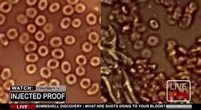 Clear Evidence Vaxxed Can Shed Graphene To Unvaxxed